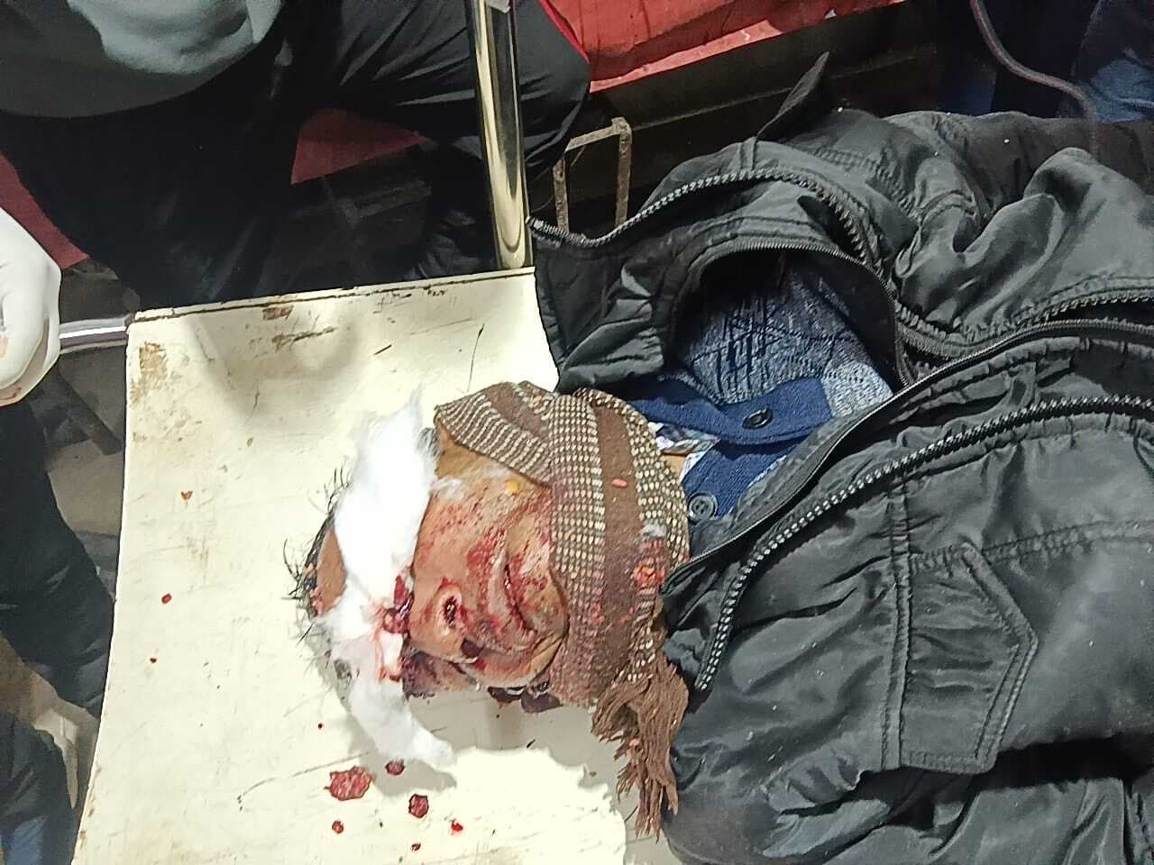 हाइवे पर दो बाइक सवार गंभीर रूप से घायल, समय पर नहीं पहुंची एंबुलेंस