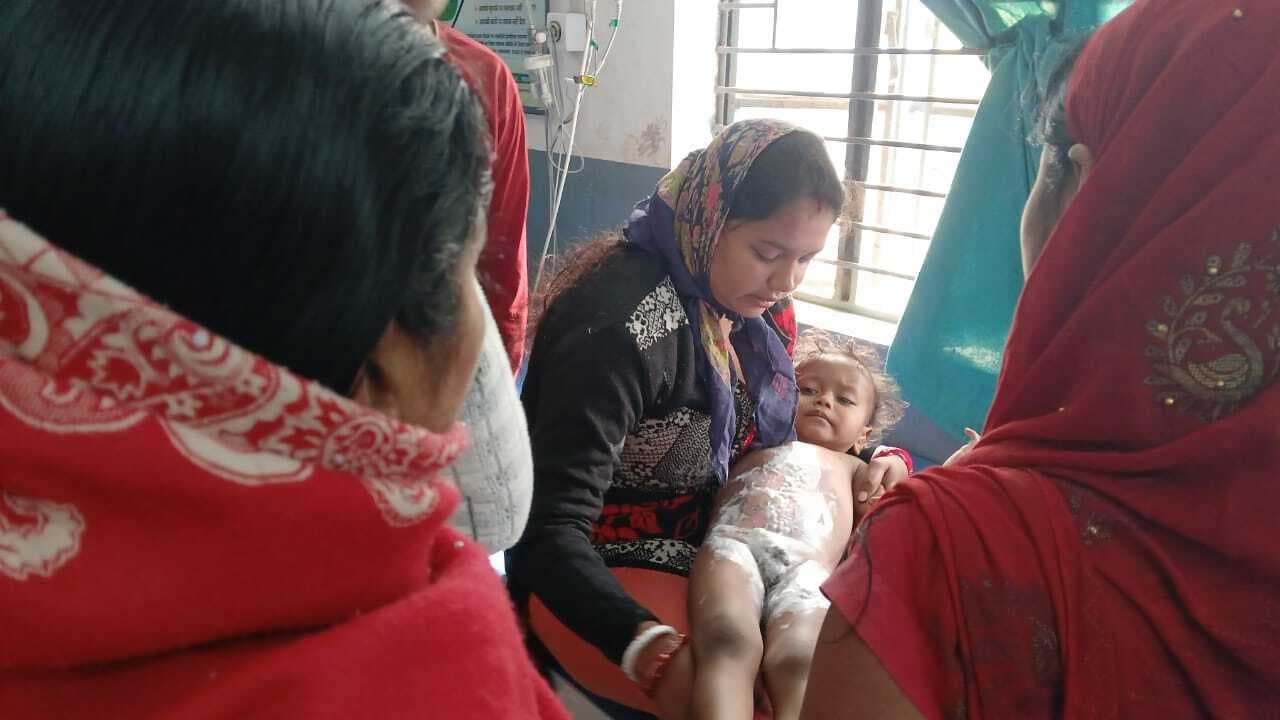 गर्म पानी से झुलसा ढाई वर्षीय मासूम, अस्पताल में भर्ती